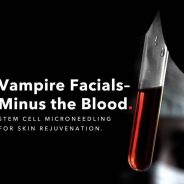 Vampire Microneedling Infusion Facial-Scary Good!